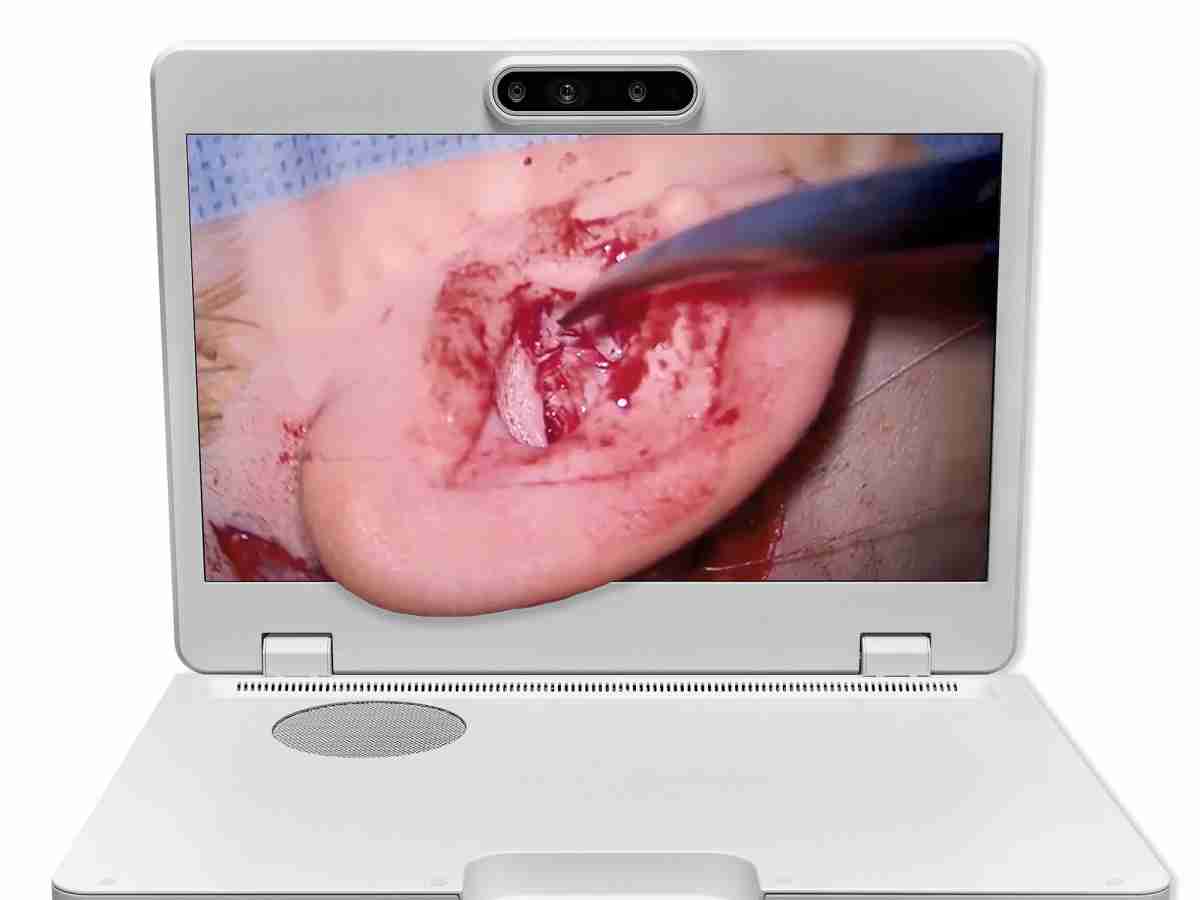 达擎之＂Heads-up 3D显微手术显示系统＂，，，整合4K裸眼3D显示及眼球追踪系统，，，，具备快速追踪人眼移动位置功能，，减轻医师长时间维持固定姿势的负担，，，让医师能有更宽广清晰的3D立体视野及更舒适的姿势来执行手术。。